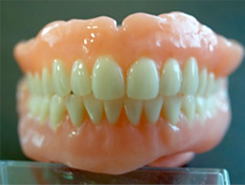 精密重合義歯